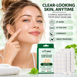 CKTUING Hydrocolloid Acne Pimple Patches (72 Ct), Ultra-Thin Transparent Face Patches, Absorbs Excess Oil & Moisture, Facial Spot Stickers, Overnight Skincare, 2 Sizes 9mm & 12mm
