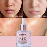 CKTUING 24K Rose Gold Serum for Face – Anti-Aging + Radiance Booster with Gold Flakes, Rose Extract, Hyaluronic Acid, Niacinamide & Vitamin C – Brightening, Hydrating & Skin Tightening – 1 oz (30ml)
