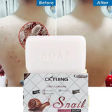 CKTUING Snail Essence Soap Bar β Collagen & Mucin Face Cleansing Soap for Wrinkle Removal, Acne Scar Treatment & Anti-Aging β Hydrating Facial Bar for Smooth, Clear Skin β 100g