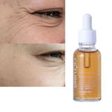 CKTUING Renewing Retinol Serum for Face - Advanced Anti-Aging Serum for Dark Circles, Wrinkles & Fine Lines - 1 Fl Oz