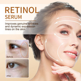 CKTUING Renewing Retinol Serum for Face - Advanced Anti-Aging Serum for Dark Circles, Wrinkles & Fine Lines - 1 Fl Oz
