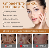 CKTUING Organic Tallow Honey Balm for Nourishing Face and Body Cream,100% Grass-Fed Beef Tallow Body Butter For Dry Skin Moisturizing With Honey, Calendula For Sensitive Skin Repair -60G(2.16Oz)