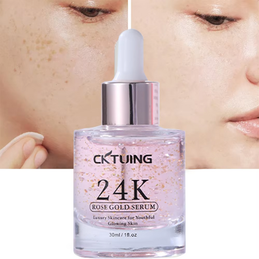 24K Rose Gold Serum for Face – Anti-Aging + Radiance Booster with Gold Flakes, Rose Extract, Hyaluronic Acid, Niacinamide & Vitamin C – Brightening, Hydrating & Skin Tightening – 1 oz (30ml)
