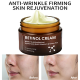 CKTUING Retinol Cream for Face – Anti-Aging, Wrinkle Reduction, Moisturizing & Brightening with 3% Active Retinol, Hyaluronic Acid, Vitamin E & Green Tea – 1.70 fl oz