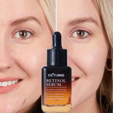 Retinol Serum for Face – Anti-Aging Serum with Retinol, Hyaluronic Acid, and Vitamin E for a More Youthful Feel – Anti Aging Retinol Serum for Skin Repair, Fine Line & Wrinkles 1 fl oz