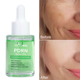 CKTUING Salmon DNA Peptide Serum for Face – PDRN Repair Serum with Hyaluronic Acid, Tea Tree & Centella Asiatica | Brightening, Firming, Dark Spot Care & Deep Moisturizing (30ml)