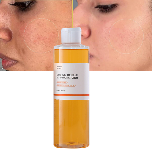 CKTUING Kojic Acid Turmeric Resurfacing Toner for Dark Spots Corrector, Toner for Acne Prone Skin, Brightening Face Exfoliator Hydrating Face Toner for Women Moisturizing - 8.45 OZ