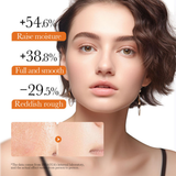 CKTUING Kojic Acid Turmeric Resurfacing Toner for Dark Spots Corrector, Toner for Acne Prone Skin, Brightening Face Exfoliator Hydrating Face Toner for Women Moisturizing - 8.45 OZ