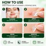 CKTUING Hydrocolloid Acne Pimple Patches (72 Ct), Ultra-Thin Transparent Face Patches, Absorbs Excess Oil & Moisture, Facial Spot Stickers, Overnight Skincare, 2 Sizes 9mm & 12mm