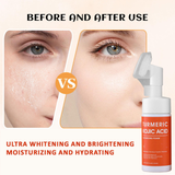 CKTUING Turmeric Kojic Acid Facial Cleanser, Brightening Foaming Face Wash with Soft Massage Heads, Kojic Acid Cleanser Exfoliating, Turmeric Cleansing for Dark Spots 4.23 oz