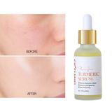 CKTUING Turmeric Serum for Dark Spots 1 Fl Oz, Turmeric Dark Spot Corrector Serum for Face & Body, Anti Aging Facial Serum, Reduces Hyperpigmentation, Age Spots, Sun Spot, Improve Skin Tone